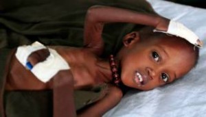 Κρίμα απ τον θεό Πεθαίνουν από την πείνα τα παιδιά στη Σομαλία