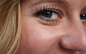 Γιατί οι ρυτίδες είναι πιο έντονες γύρω από τα μάτια