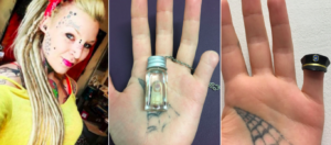 Βρετανίδα έκοψε το δάχτυλο της γιατί ... ήθελε να το φοράει σαν μενταγιόν (Φωτό)