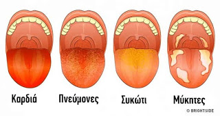 13 Πράγματα που Θέλει να σας Πει η Γλώσσα σας Για την Υγεία σας